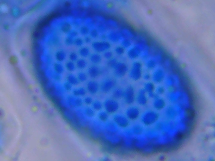 Spora (1000x zvětšení, cottonblue)