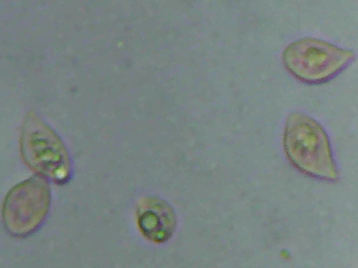 Spory (600x zvětšení, KOH + kongo red)