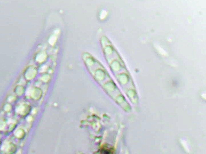 Spory (600x zvětšení, KOH)