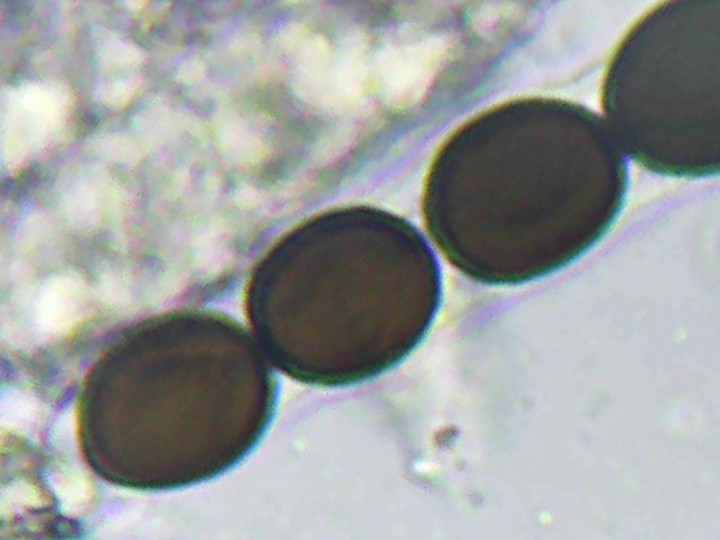 Spory (600x zvětšení, KOH)