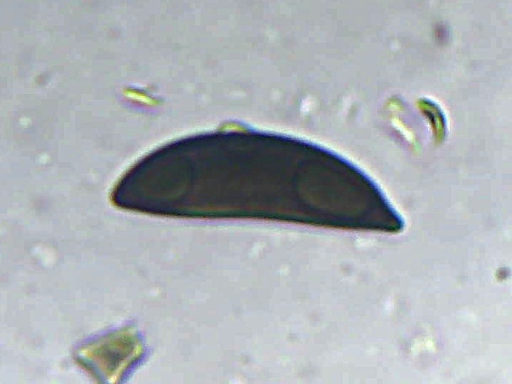 Spora (600x zvětšení, KOH)