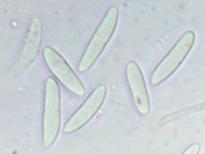 Spory (600x zvětšení, voda)