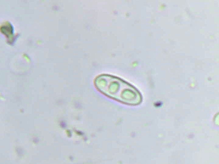 Spora (600x zvětšení, KOH)
