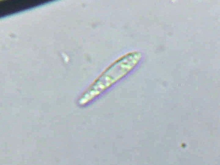 Spora (600x zvětšení, voda)