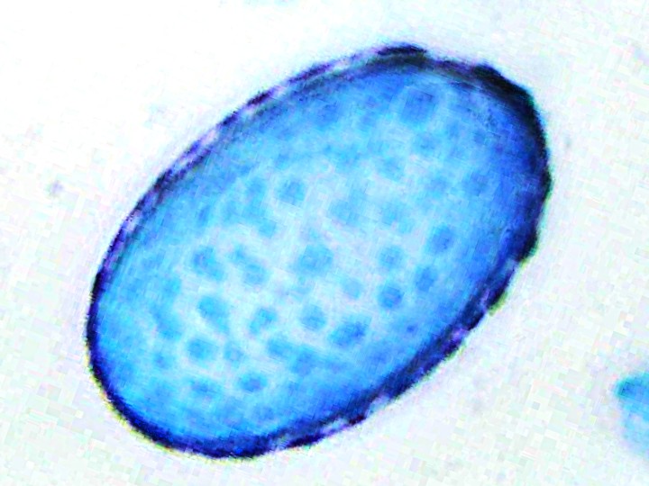 Spora (1000x zvětšení, cottonblue)