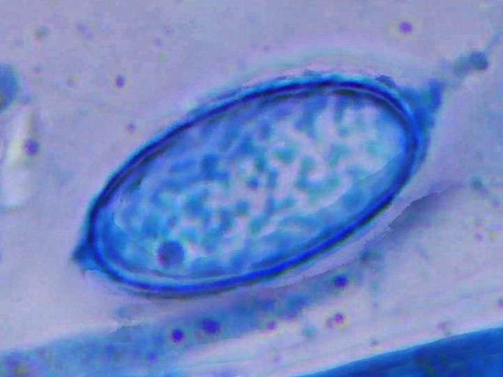 Spora (1000x zvětšení, cottonblue)
