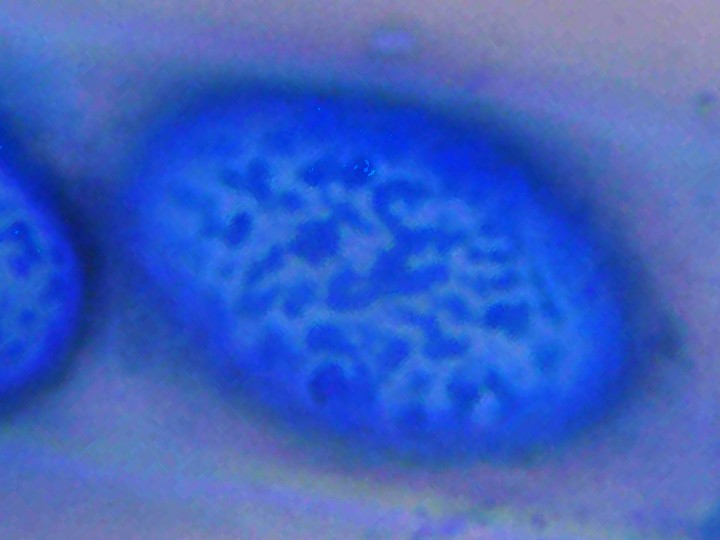 Spora (1000x zvětšení, cottonblue)