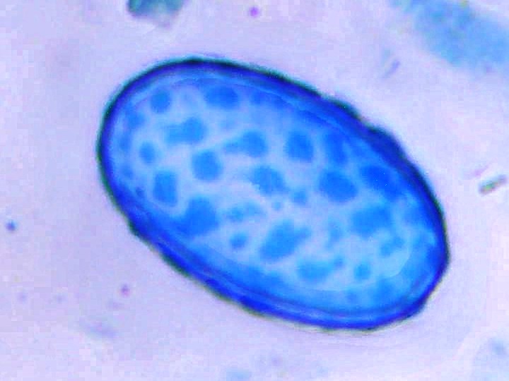 Spora (1000x zvětšení, cottonblue)