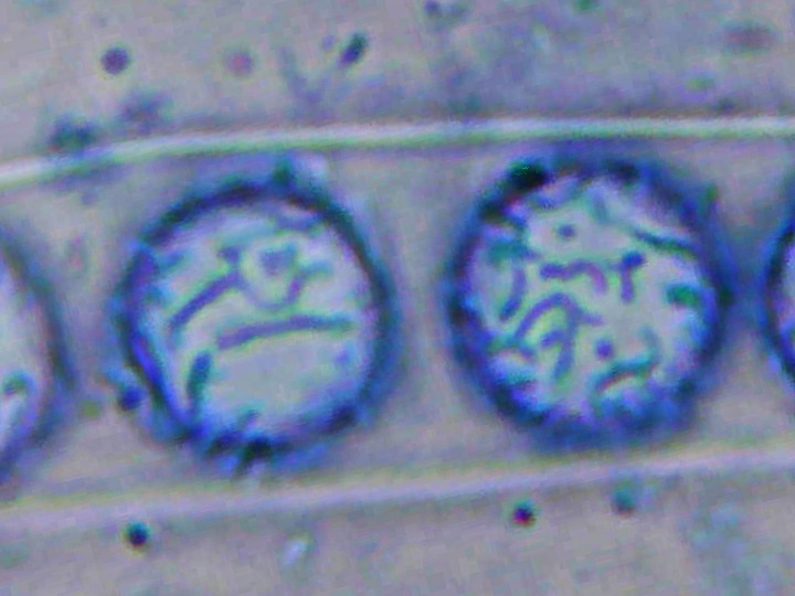 Spory (1000x zvětšení, cottonblue)