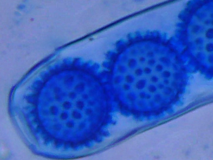 Spory (1000x zvětšení, cottonblue)