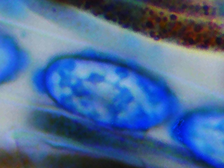 Spora (1000x zvětšení, cottonblue)