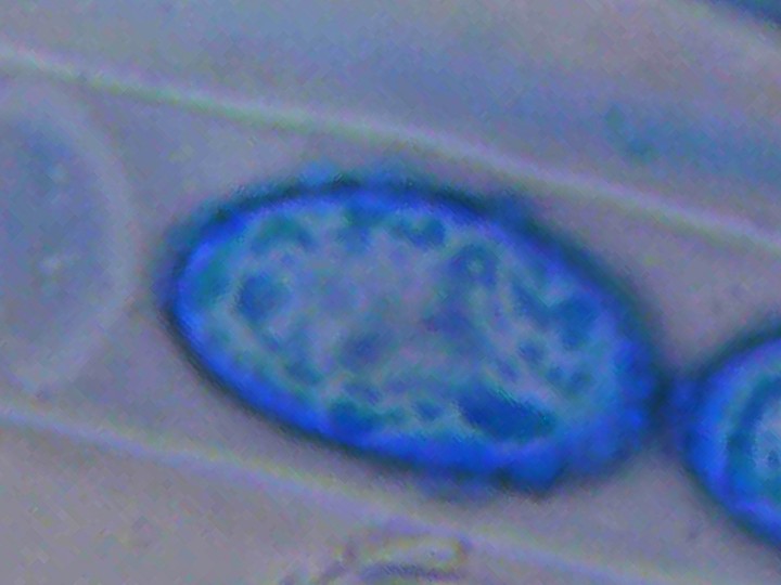 Spora (1000x zvětšení, cottonblue)